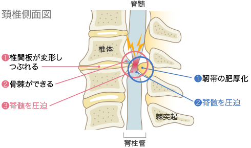 keitsui_il03 keitsui_il03
