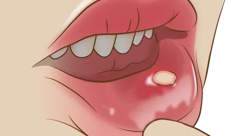 lip lip